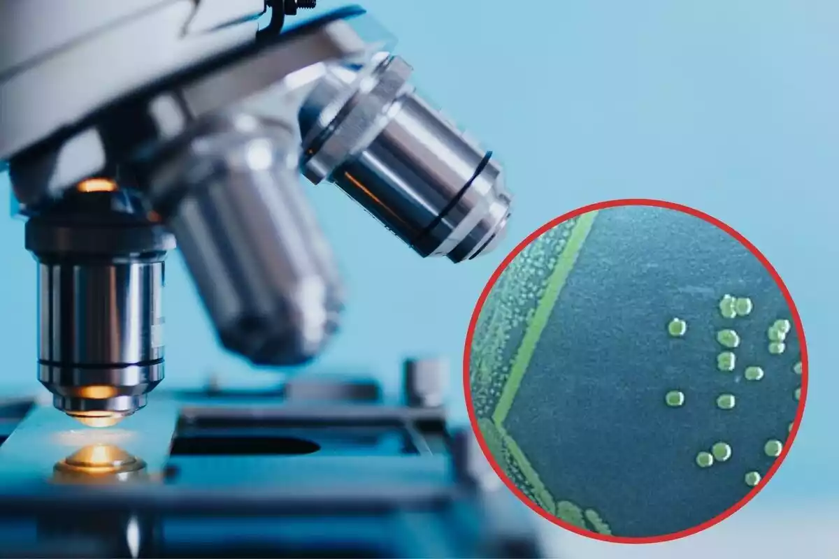 Muntatge fotos d'un microscopi amb la bacteria Shigella