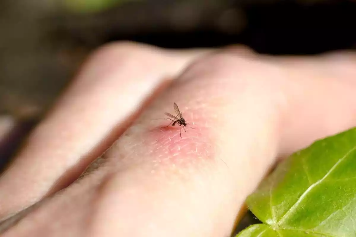 Un mosquit picant una mà