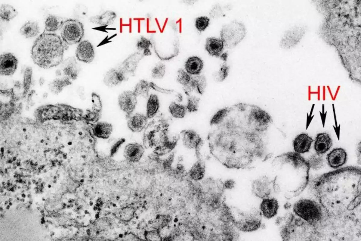 Imatge que mostra la presència de virus HTLV-1 i VIH