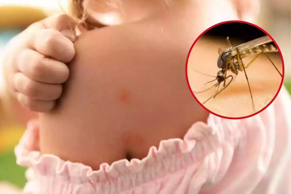 Fotomuntatge d'una nena rascant-se picades i un mosquit