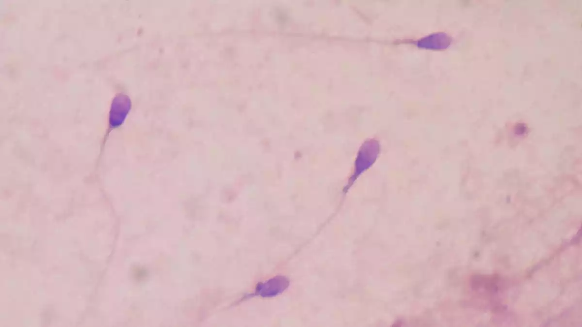 Imatge d'espermatozoides al microscopi