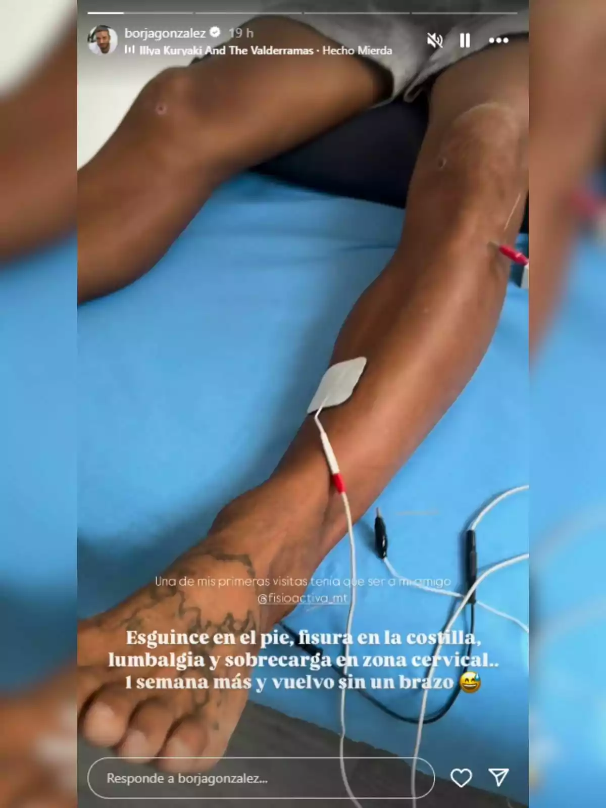 Borja González estirat en una llitera amb elèctrodes a la cama i cables connectats, mostrant una lesió i un missatge sobre diverses lesions físiques. Borja González estirat en una llitera amb elèctrodes a la cama i cables connectats, mostrant una lesió i un missatge sobre diverses lesions físiques.