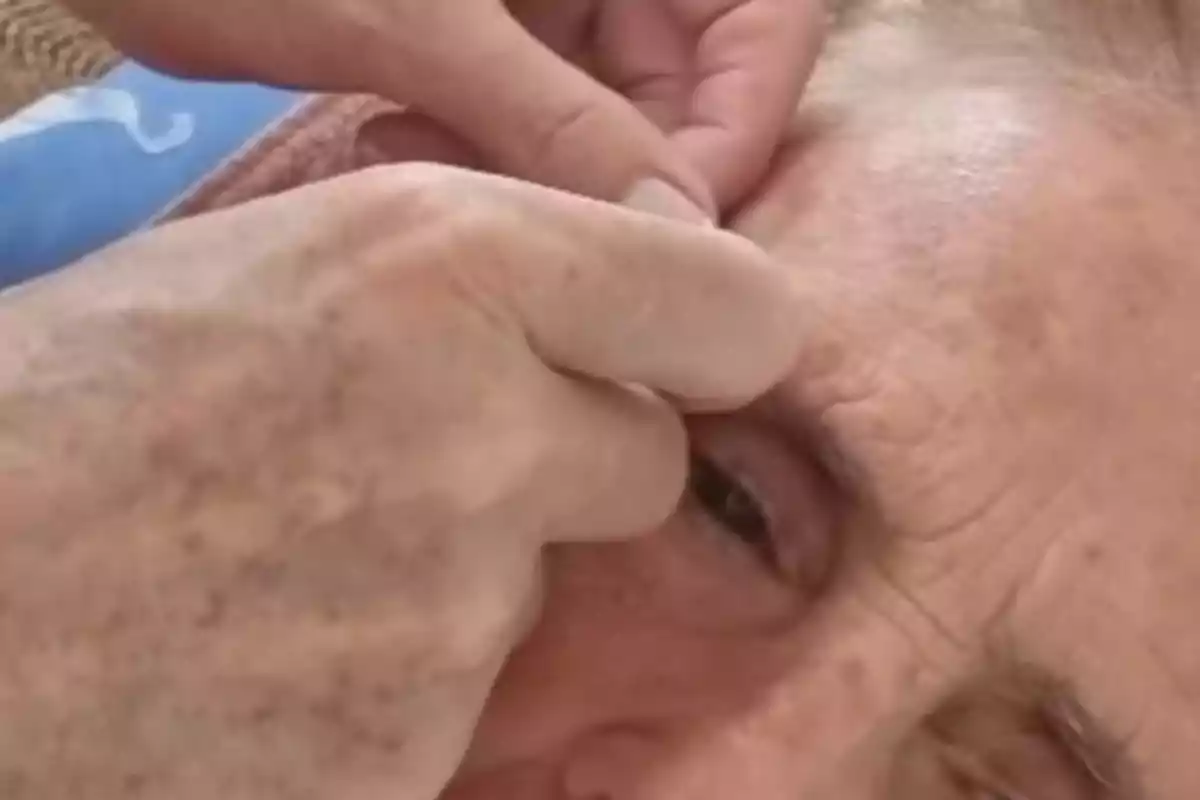 Mercedes Milá mayor acostada mientras alguien le ayuda a limpiar o revisar el área de su ojo izquierdo usando los dedos. Mercedes Milá mayor acostada mientras alguien le ayuda a limpiar o revisar el área de su ojo izquierdo usando los dedos.