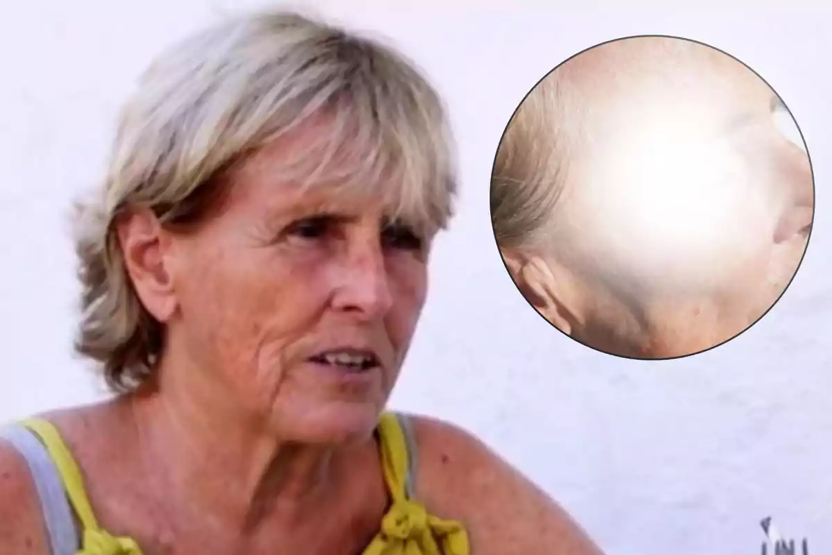 Dona de cabell curt i ros amb expressió seriosa, porta una brusa de tirants i al fons hi ha una paret blanca; a la cantonada superior dreta hi ha un cercle que mostra un primer pla de la seva cara amb una zona il·luminada.