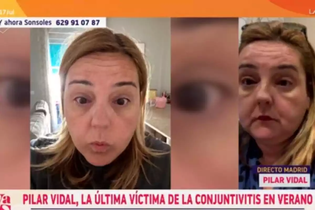 Dues fotografies d’una dona amb l’ull esquerre enrogit i aspecte cansat, acompanyades d’un titular a la part inferior que esmenta la conjuntivitis a l’estiu Dues fotografies d’una dona amb l’ull esquerre enrogit i aspecte cansat, acompanyades d’un titular a la part inferior que esmenta la conjuntivitis a l’estiu