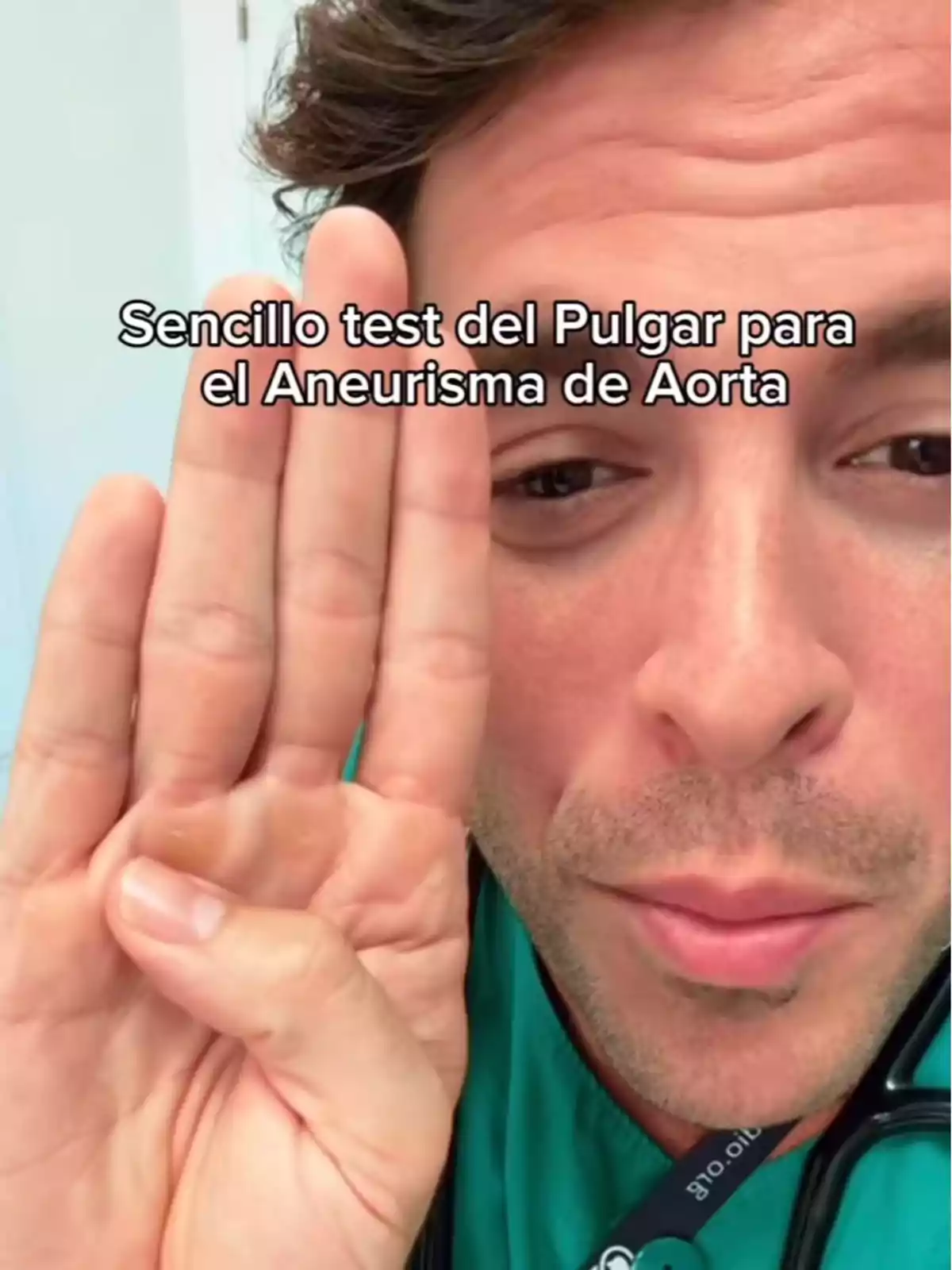 Aurelio Rojas con bata médica mostrando la mano con el pulgar extendido hacia la palma y texto que dice Sencillo test del Pulgar para el Aneurisma de Aorta Aurelio Rojas con bata médica mostrando la mano con el pulgar extendido hacia la palma y texto que dice Sencillo test del Pulgar para el Aneurisma de Aorta