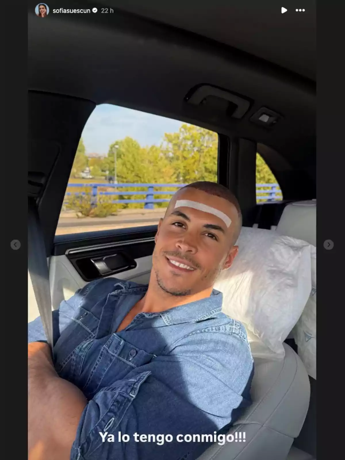 Kiko Jiménez con una venda en la frente sentado en el asiento trasero de un coche con una camisa de mezclilla y un cojín blanco detrás de él