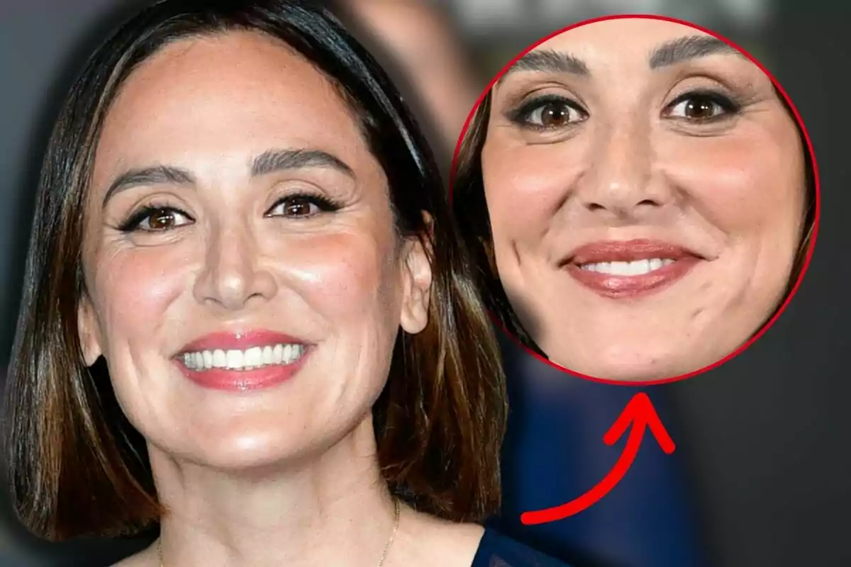 Tamara Falcó somrient amb un requadre ampliant la zona de la seva barbeta i una fletxa vermella assenyalant l’àrea destacada Tamara Falcó somrient amb un requadre ampliant la zona de la seva barbeta i una fletxa vermella assenyalant l’àrea destacada