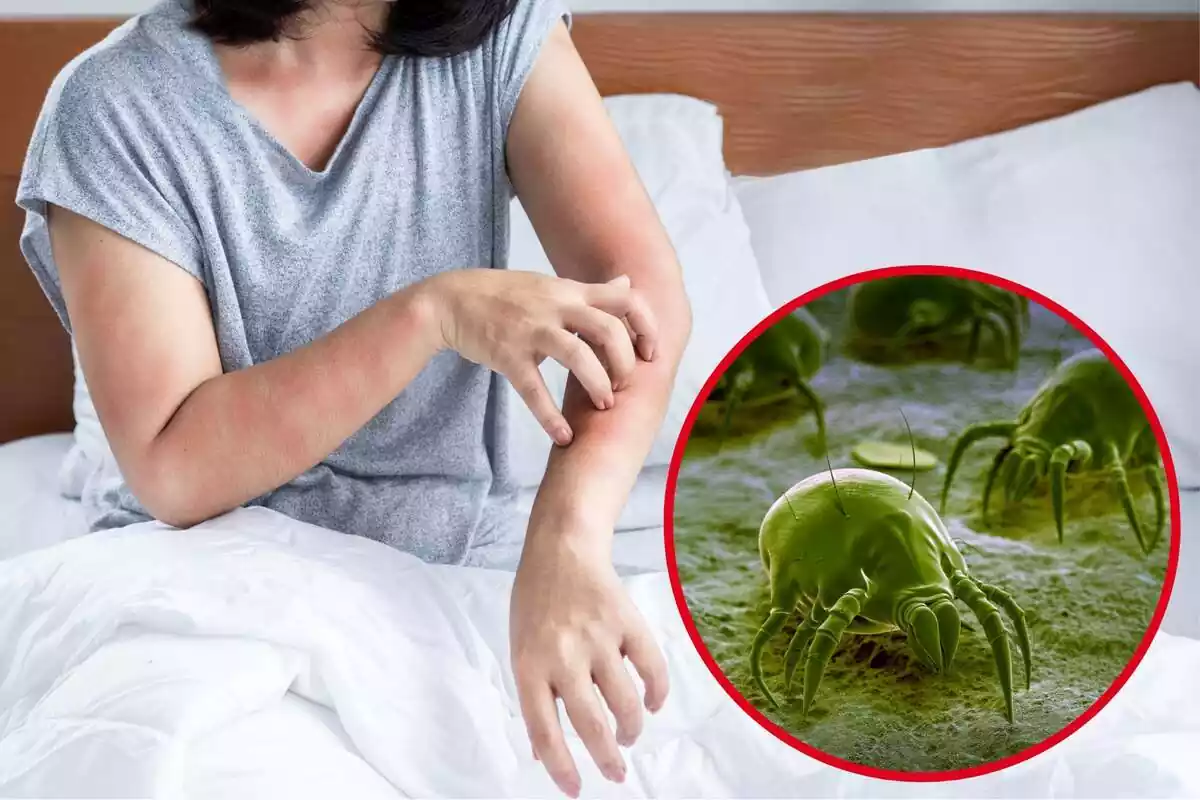 Montaje con una mujer en una cama rascándose el brazo y un círculo con una imagen en la que aparecen varios ácaros