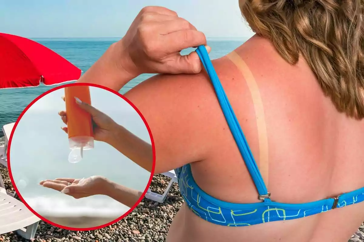 Una dona ensenya la cremada del sol a la platja, i al cercle, un pot de protecció solar Una dona ensenya la cremada del sol a la platja, i al cercle, un pot de protecció solar