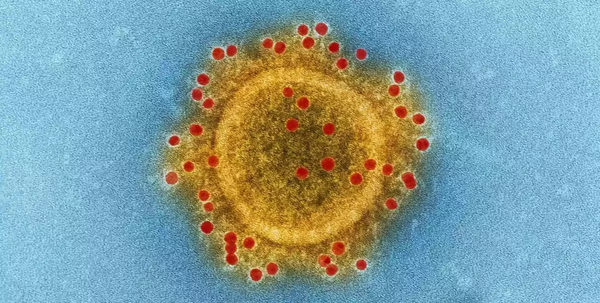 Imatge creada pel NIAID amb una partícula del MERS-CoV acolorida