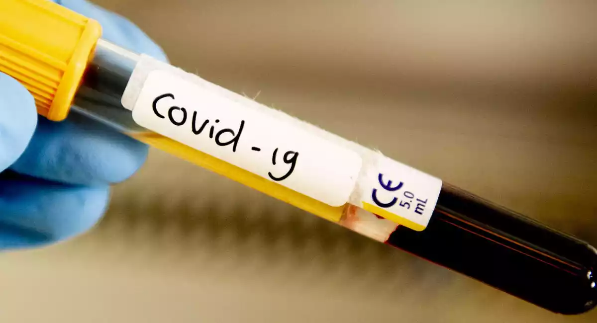 Imatge d'una mostra de sang per testar el covid-19 el març de 2020