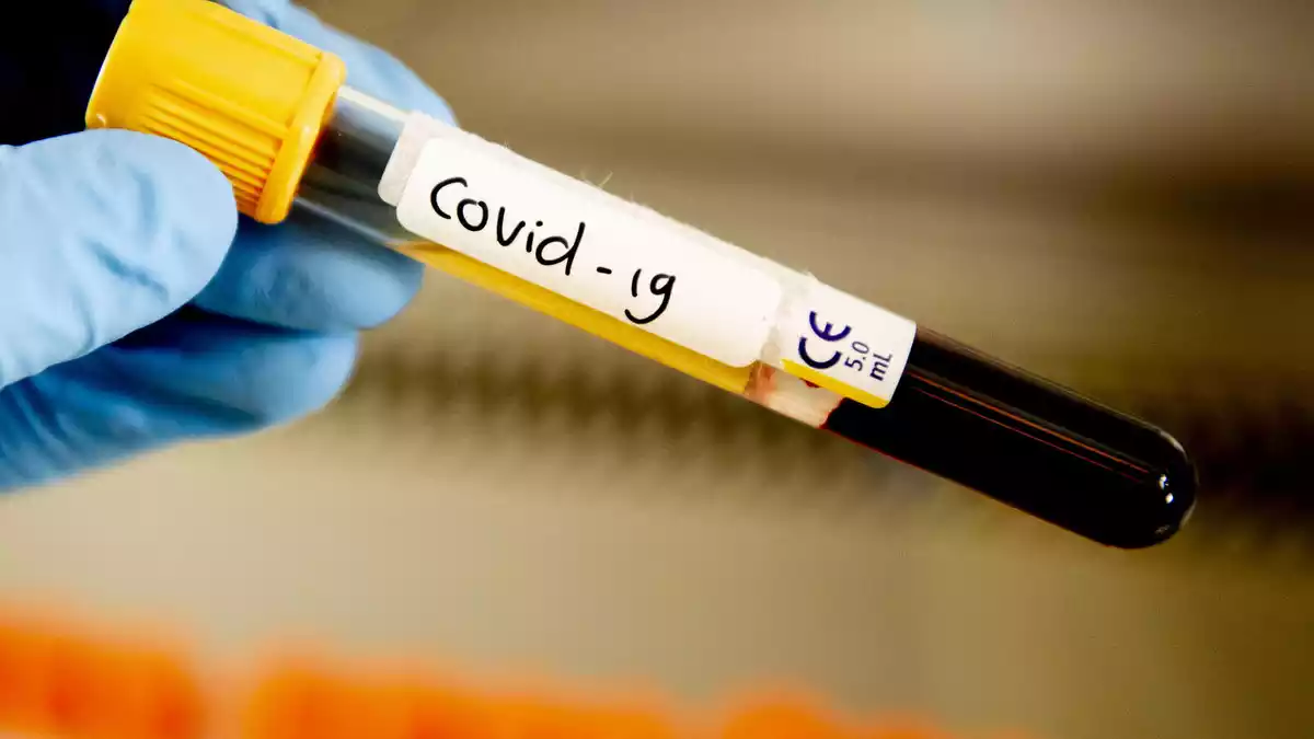 Imatge d'una mostra de sang per testar el covid-19 el març de 2020