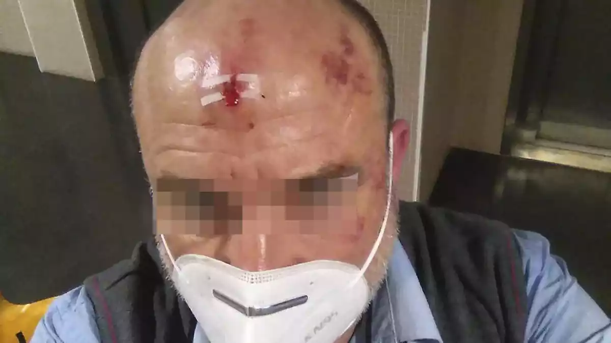 Imatge d'un revisor de Renfe, després d'una agressió