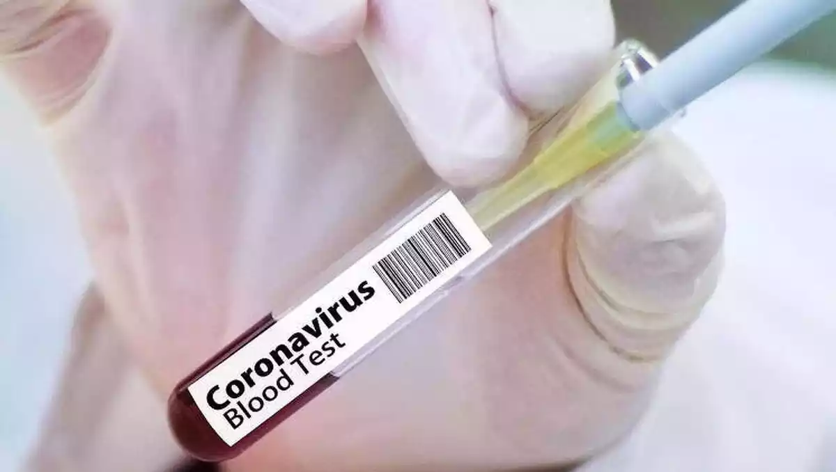 Test de sang de coronavirus